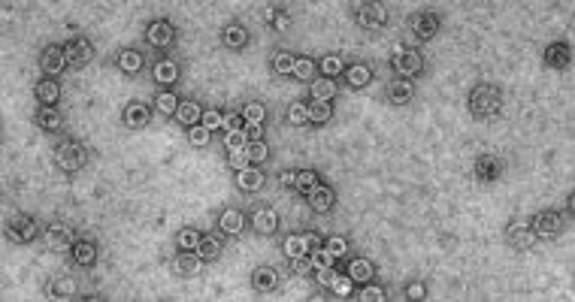A microscopic image from Adam Zlotnick's group showing viruses.
