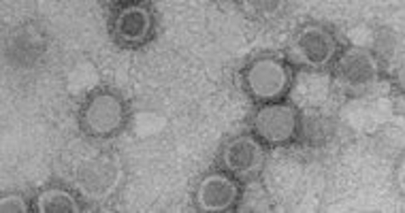 A microscopic image from Tuli Mukhopadhyay's group showing the structure of different membrane bound RNA viruses.
