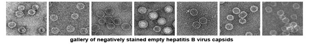 A gallery of negatively stained empty hepatitis B virus capsids.